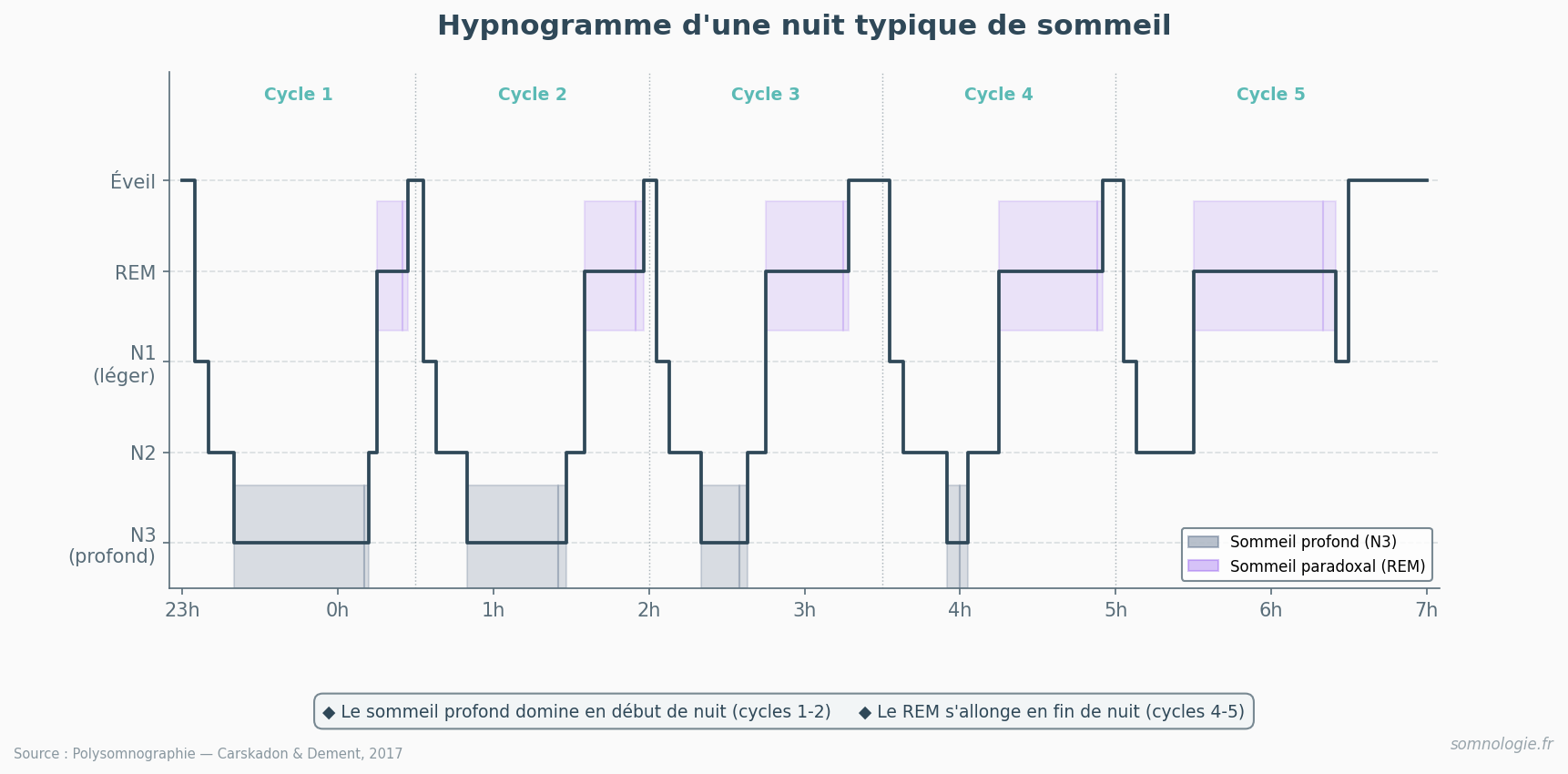 Hypnogramme montrant les 5 cycles de sommeil avec les stades N1, N2, N3 et REM